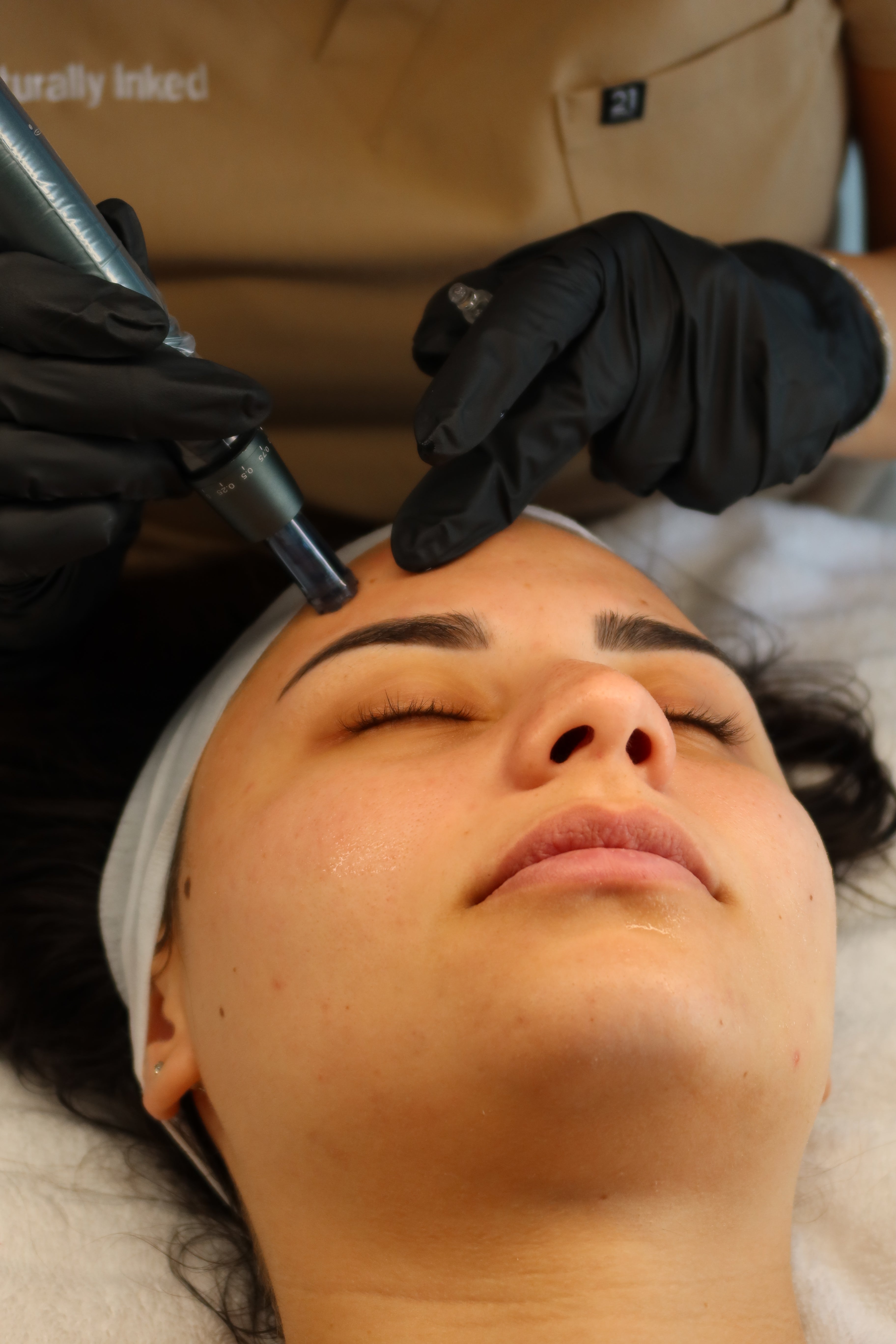 Skin Needling (Microneedling)