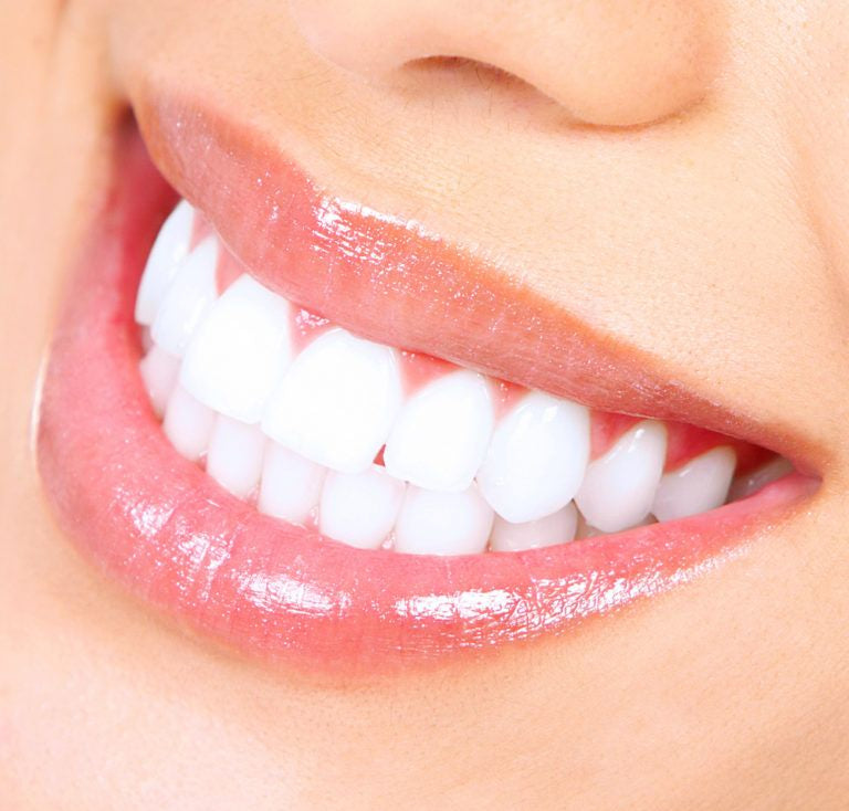 Teeth-Whitening-768x735.jpg.optimal.jpg
